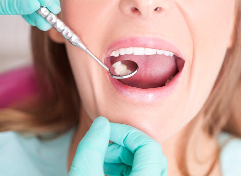 定期検診・クリーニング