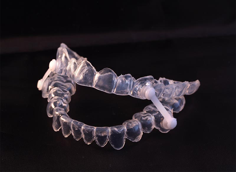 スリープスプリント（睡眠時無呼吸症候群治療）